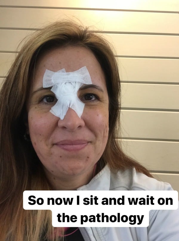 woman sitting with pressure dressing on face